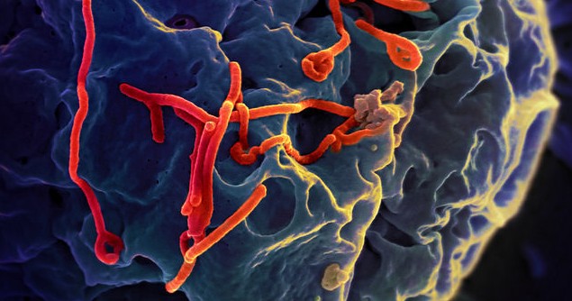 Ebola virus. Image credit: Flickr (NIAID)